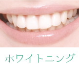ۥ磻ȥ˥